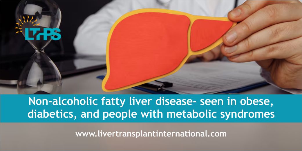 Non-alcoholic fatty liver disease- seen in obese, diabetics, and people with metabolic syndromes - Liver Transplant International