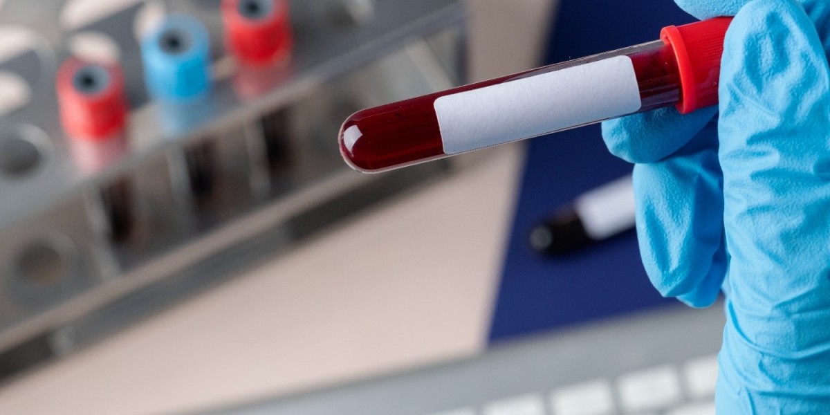 Blood Test at Home: A Convenient Solution for All Ages